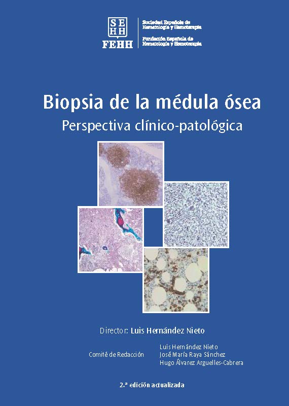 PORTADA Biopsia de la médula ósea 2ª edición 2017